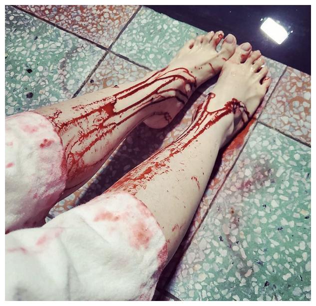 蔡依林发双脚染血照惊动粉丝经纪人紧急回应真相太感动