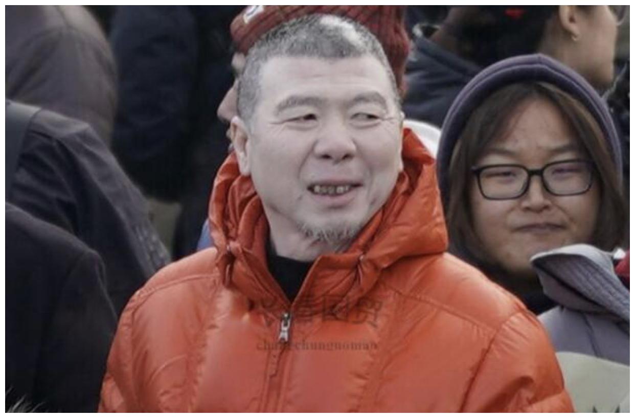 冯小刚白癜风加重?斑秃明显气色不佳,他的皮肤白到发光