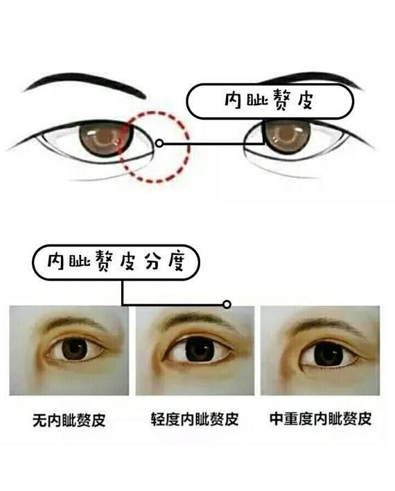 (下篇)|内眦赘皮|开眼角|疤痕_新浪新闻