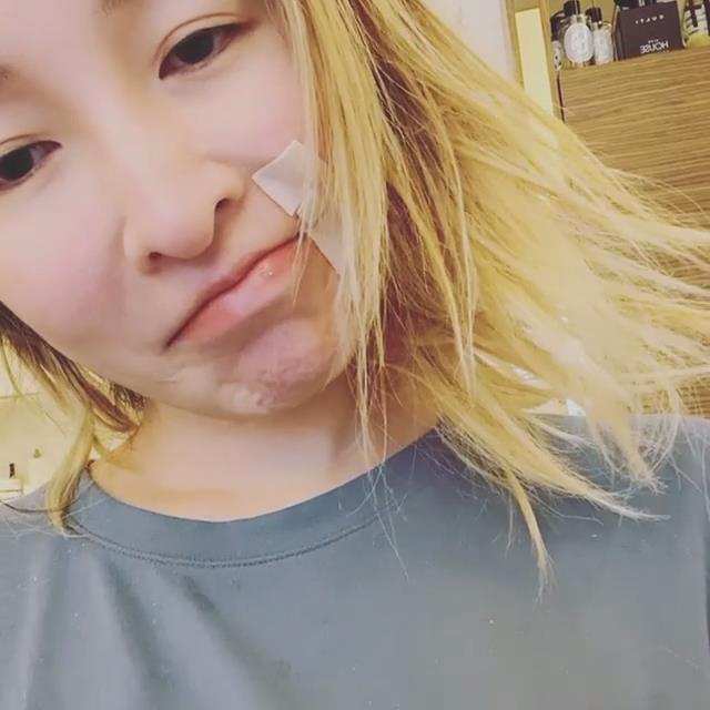 萧亚轩疑和黄皓分手,台媒爆料称被狗咬伤后毁容,缺乏安全感导致休闲区蓝鸢梦想 - Www.slyday.coM 萧亚轩疑和黄皓分手,台媒爆料称被狗咬伤后毁容,缺乏安全感导致休闲区蓝鸢梦想 - Www.slyday.coM