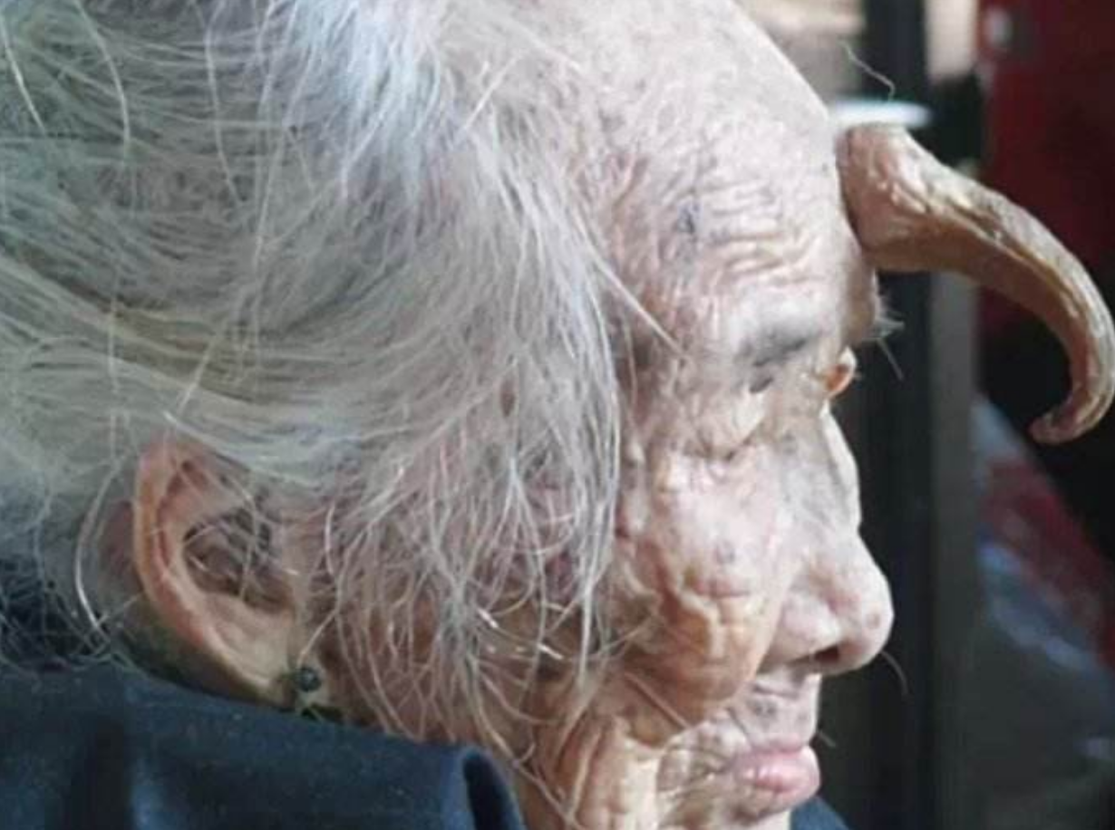 老人百岁额头长角,面对儿女劝阻,她说出了一个秘密