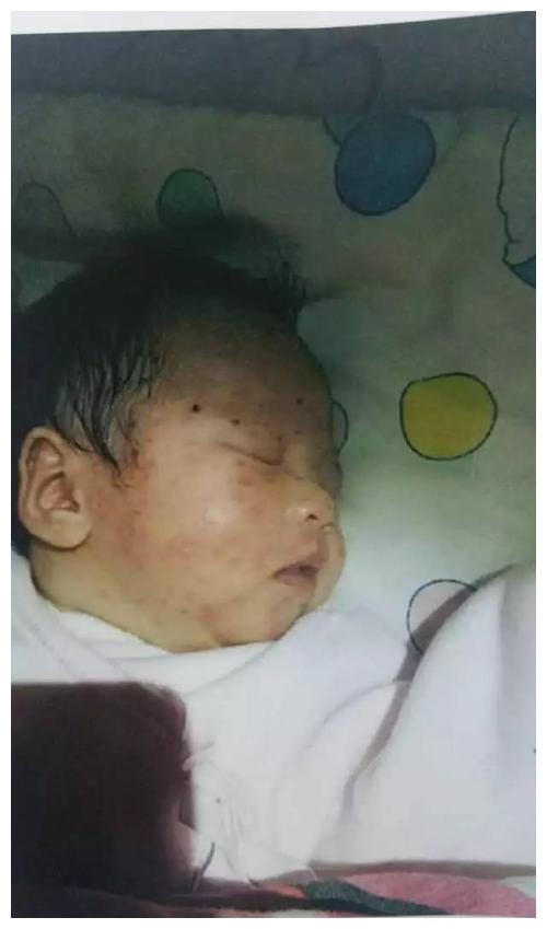 "黑炭宝宝"火了!出生时丑哭全家人,两个月后却逆袭成"团宠"