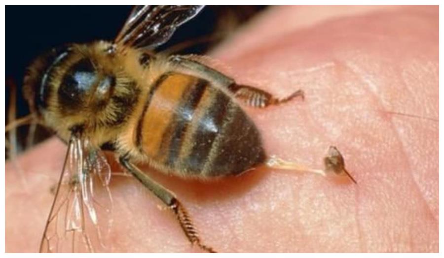 被蜜蜂"亲吻"后的香肠嘴, 从他们的眼里我看到了绝望|蜜蜂|香肠|上嘴