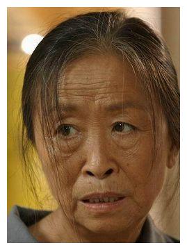 "丑娘"张少华因病去世,生前住院照片曝光,病痛折磨仍面带微笑