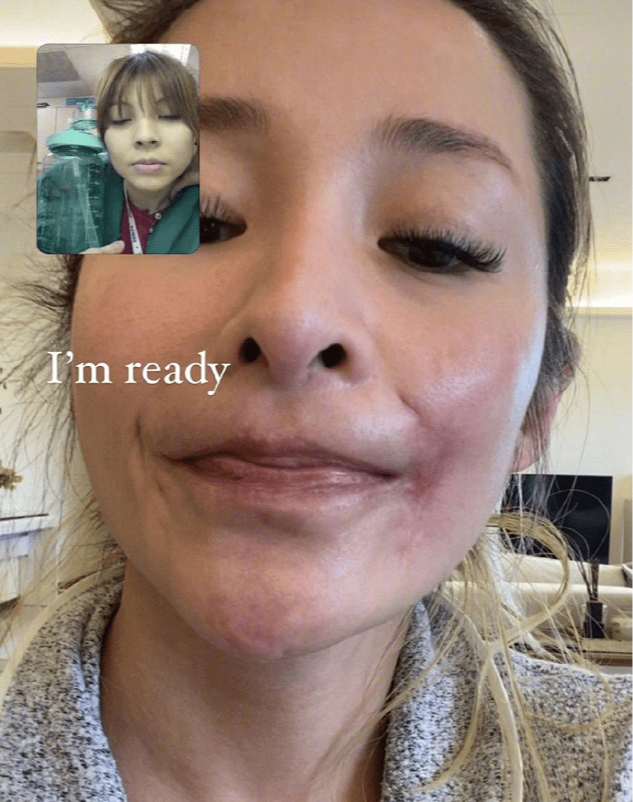 萧亚轩疑和黄皓分手,台媒爆料称被狗咬伤后毁容,缺乏安全感导致休闲区蓝鸢梦想 - Www.slyday.coM 萧亚轩疑和黄皓分手,台媒爆料称被狗咬伤后毁容,缺乏安全感导致休闲区蓝鸢梦想 - Www.slyday.coM