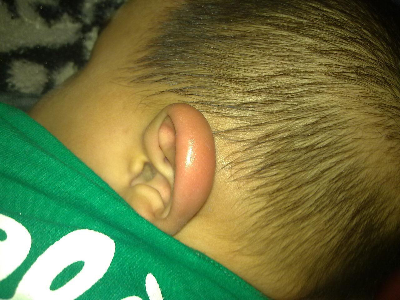 想要拥有高 挺鼻梁 这个误区实在让孩子受伤 很多家长却都在做