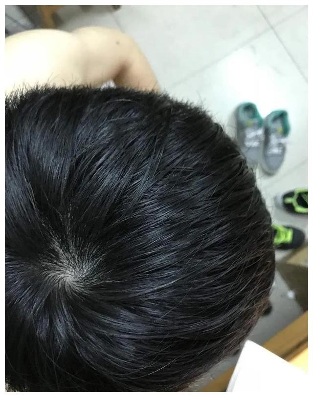 你头顶几个旋?有三个的不是一般人!