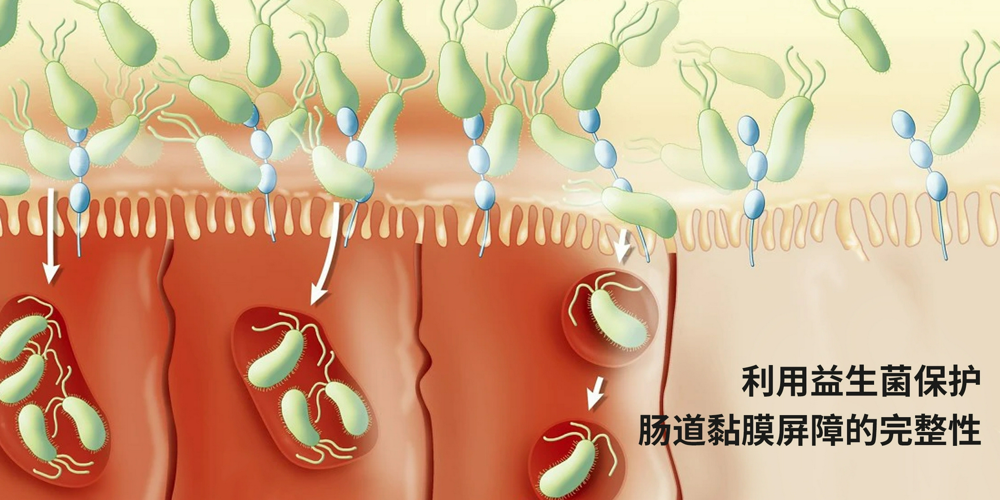 但如果是利用益生菌保护肠道黏膜屏障的完整性,那么还是推荐的,只是要