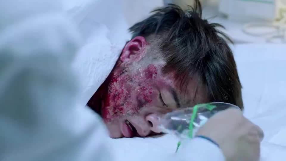 急诊科医生:医院接诊爆炸伤患,主任累到手抽筋,医生看出不对