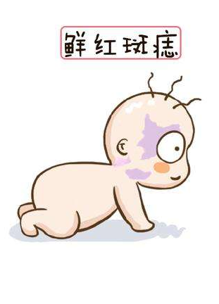 鲜红斑痣有哪些临床表现?