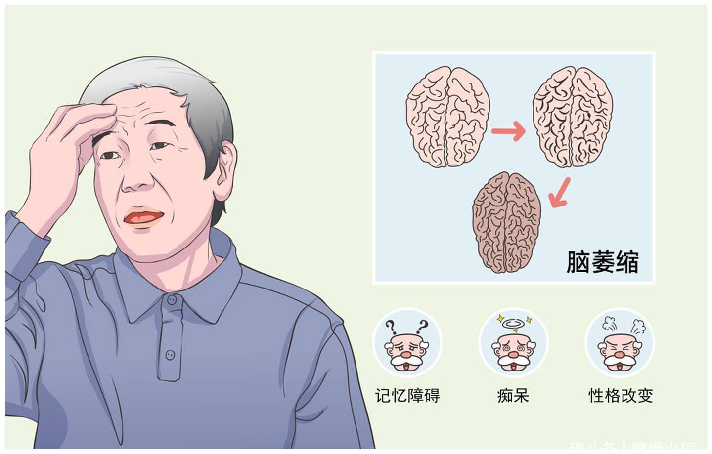 眼底萎缩是怎么回事_语音科普_杏林普康