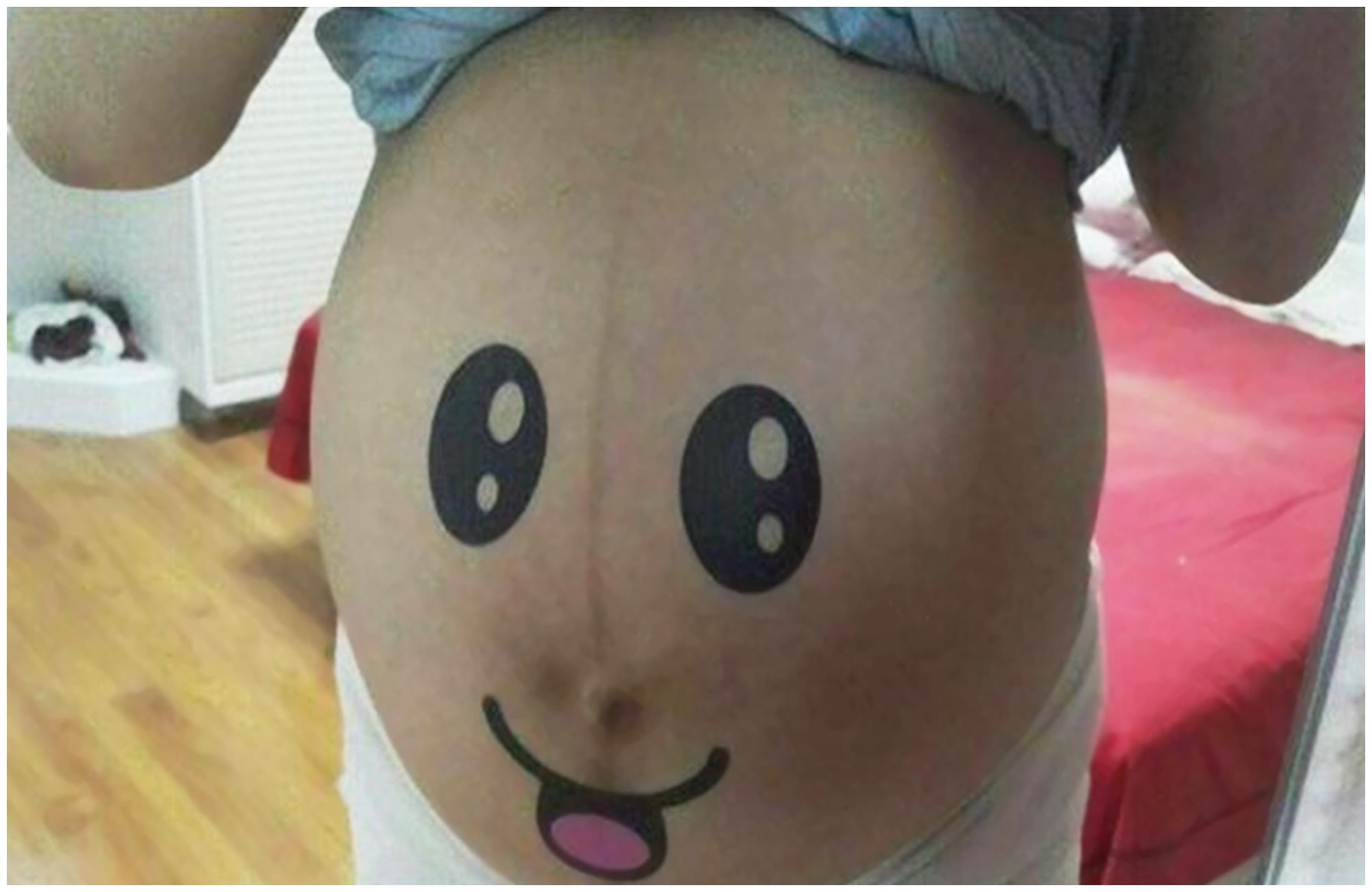 尖肚圆肚悬浮肚不同孕肚遭罪情况差异大后者最惨