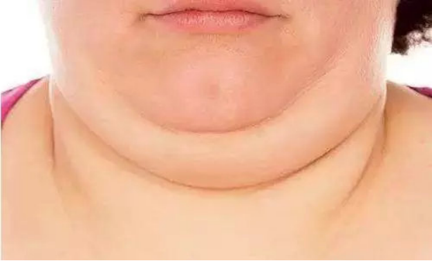 脖子粗寿命短?研究表明:这是真的!|代谢综合征|颈围|脖子_新浪新闻