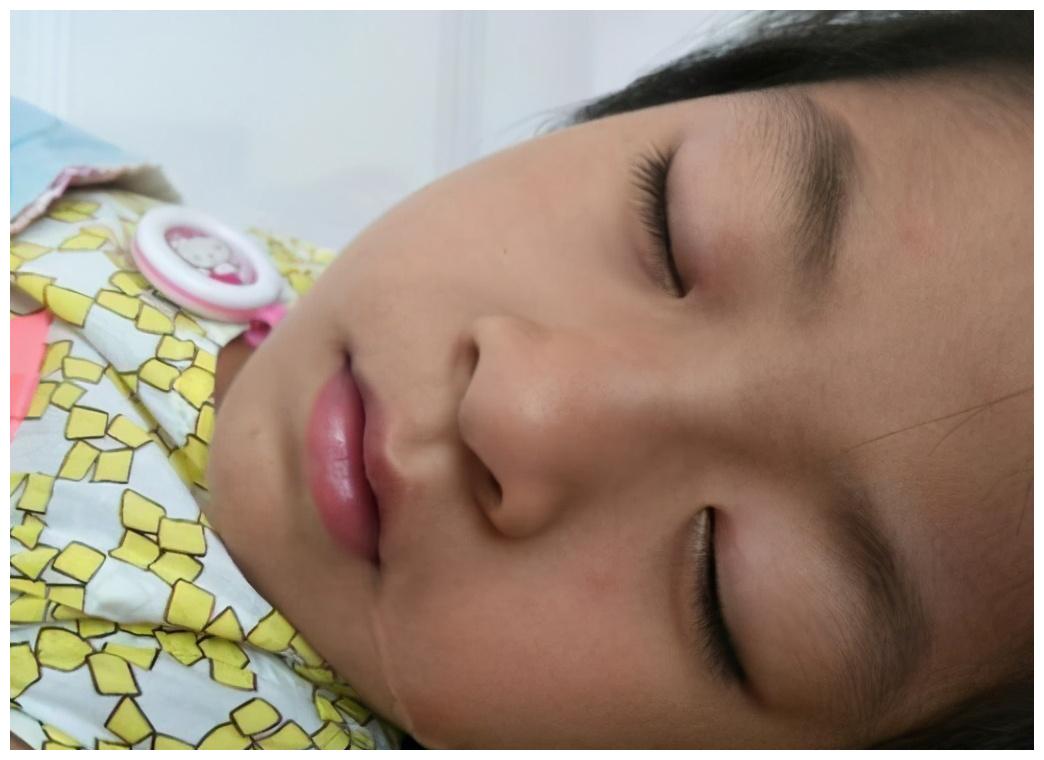 有积食的孩子脸色多呈蜡黄色,没有一点光泽,鼻梁上能明显看出有青筋