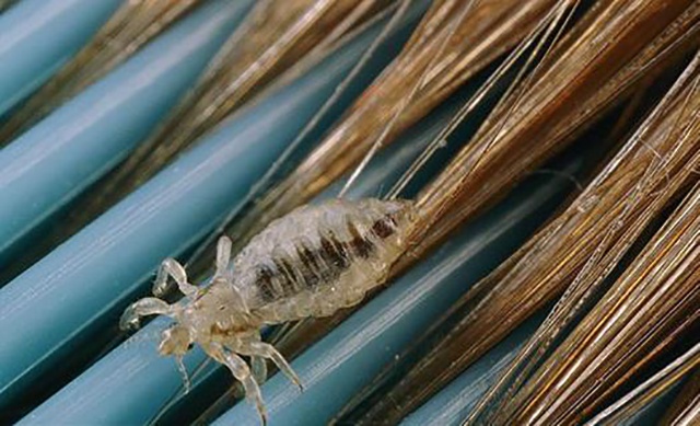 母亲为帮女儿去头虱竟用农药焗头,女儿进icu