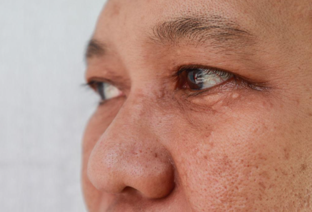 医生提醒:吸烟的人,经常出现6个表现,肺或已经"痛苦不堪"