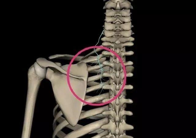 2.胸椎小关节紊乱背部疼痛时间一长,肌肉劳损是很普遍的,例如,菱形肌