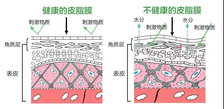 科宇创研化妆品oem皮肤屏障受损与皮肤病皮肤屏障是人体肌肤的天然