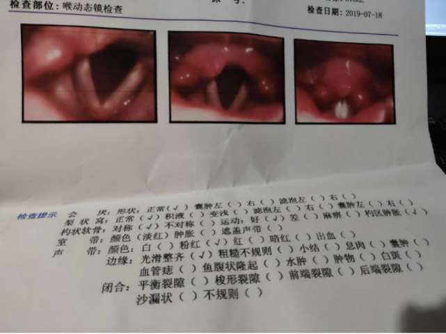 三,当咽喉部颈项发炎或其他病变时,易经淋巴管分支向这些内分泌器官