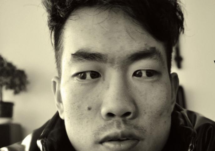 有着"双瞳孔"的人,真能看见常人看不见的东西吗?真相让人意外