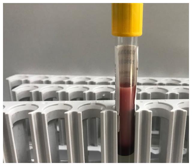 29岁女子晕倒就医,医生告诫:此物是血脂助长剂,怎能天天喝休闲区蓝鸢梦想 - Www.slyday.coM 29岁女子晕倒就医,医生告诫:此物是血脂助长剂,怎能天天喝休闲区蓝鸢梦想 - Www.slyday.coM