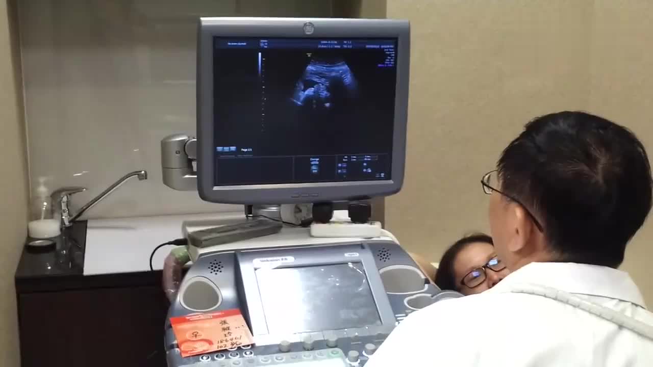 孕32周产检做四维彩超全过程,宝宝五官看的很清楚,好像在笑!