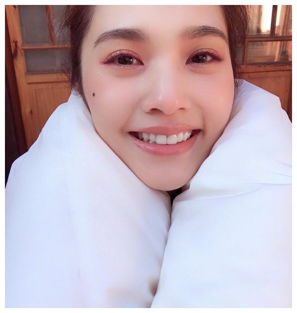 杨丞琳右脸的痣被怀疑后天加工凌晨回应天生的