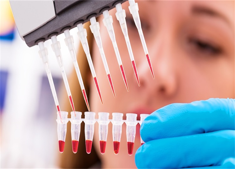 自体脂肪填充哪里好（自体填充用哪里脂肪比较好）