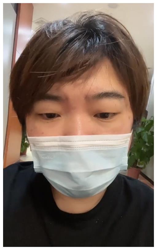 王牌对王牌导演吴彤晒视频自曝踩空台阶骨折