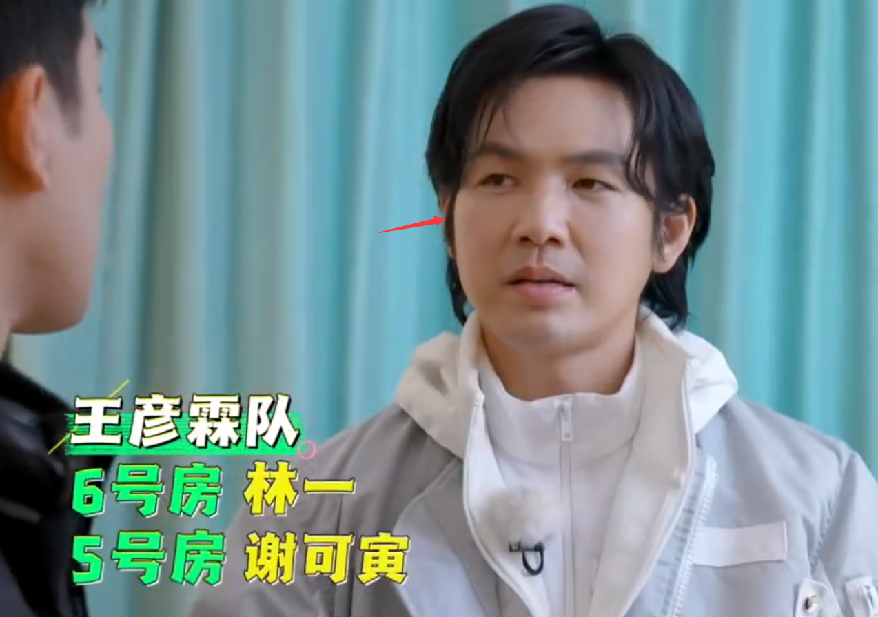 48岁钟汉良参加综艺面部僵硬医美痕迹明显生图精修差别大