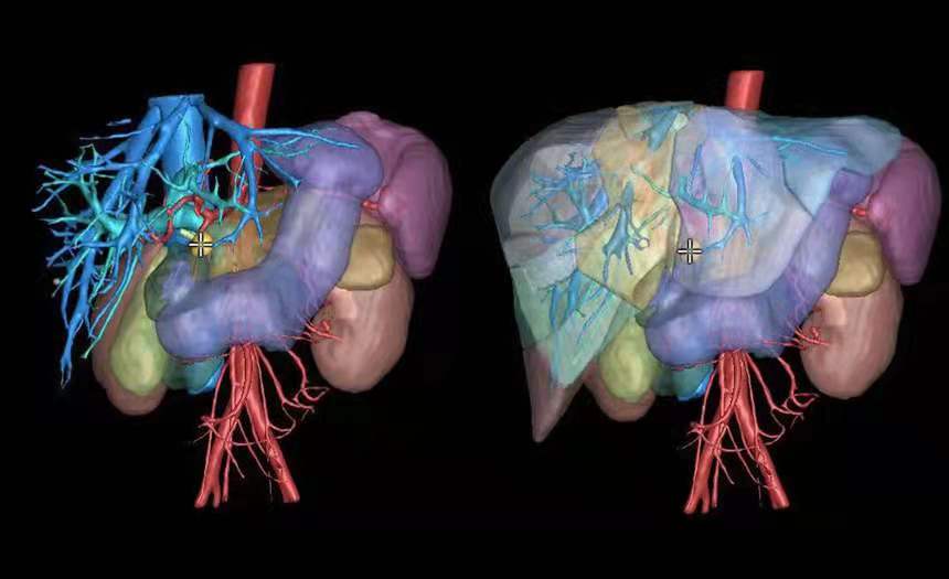 全球AI医学影像辅助诊断发明专利排行榜公布,商汤荣登全球第五-科记汇