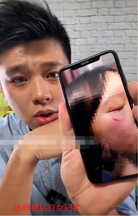 狗仔曝徐峥曾酒后打女记者,用脚踢脸3次致其眼出血,道歉后秒删休闲区蓝鸢梦想 - Www.slyday.coM 狗仔曝徐峥曾酒后打女记者,用脚踢脸3次致其眼出血,道歉后秒删休闲区蓝鸢梦想 - Www.slyday.coM