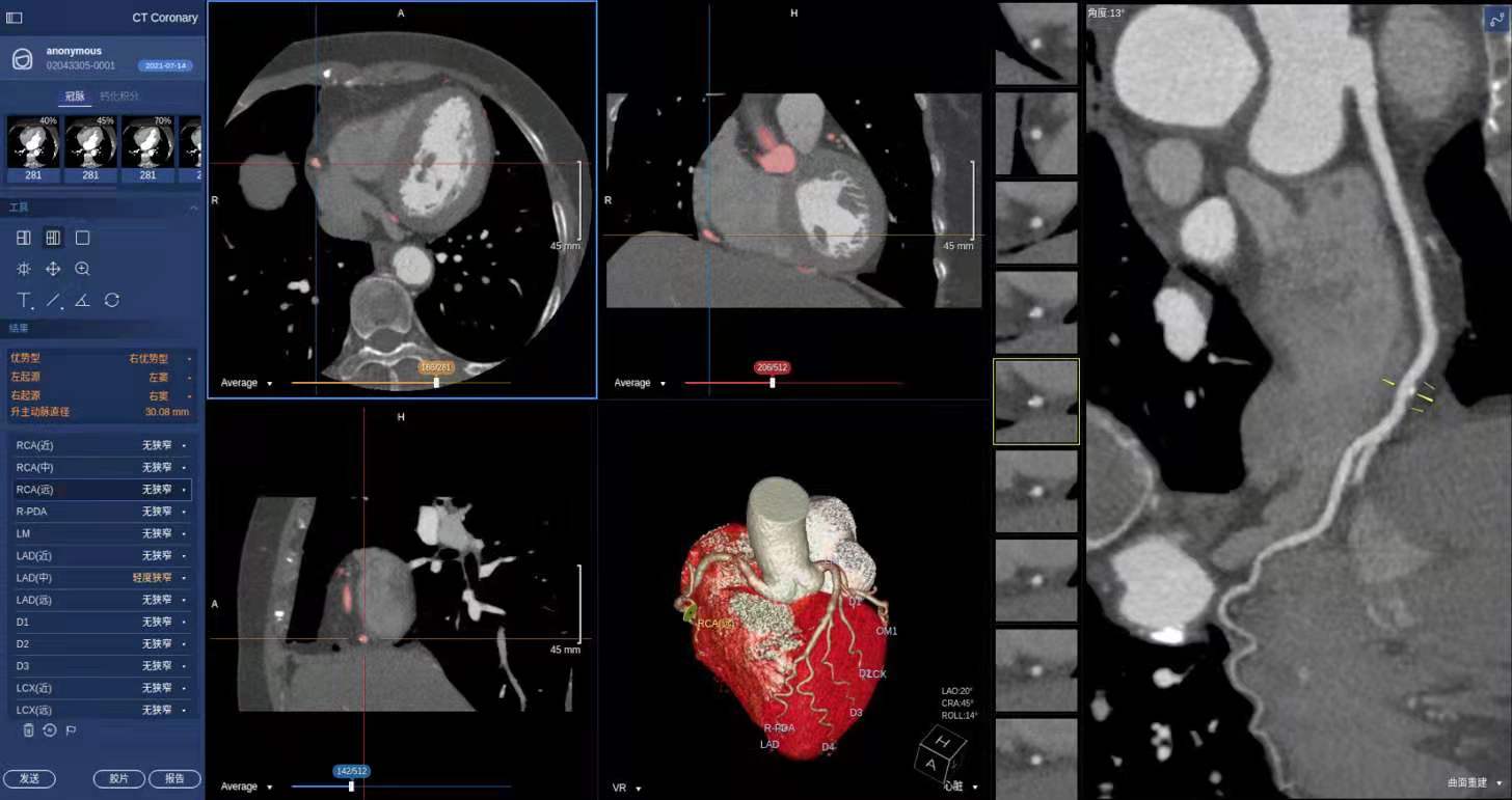 全球AI医学影像辅助诊断发明专利排行榜公布,商汤荣登全球第五-科记汇