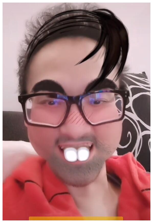 疑赵英俊十个月前化疗头发稀疏脱发严重