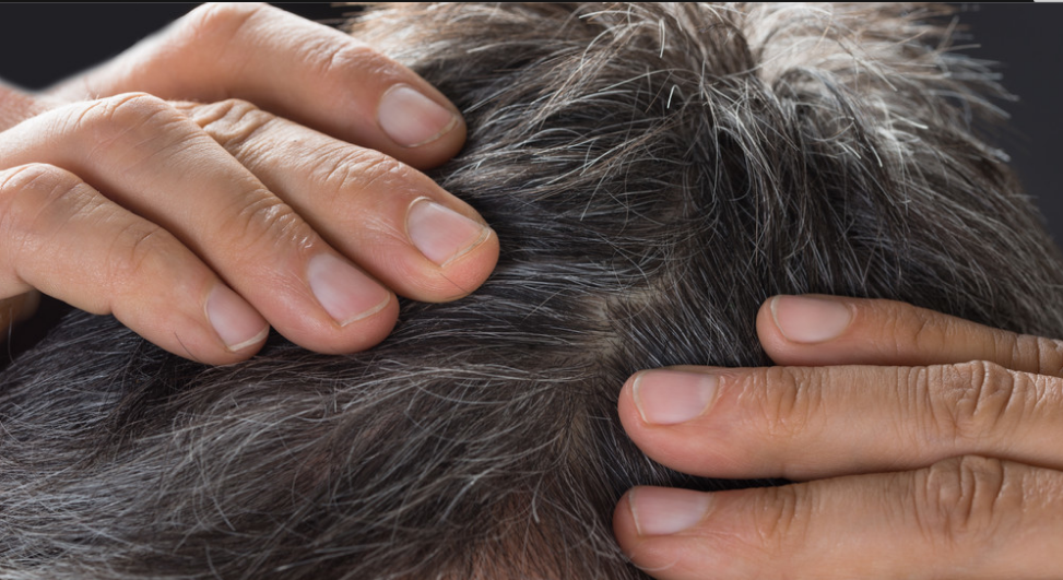 后脑勺的白发要小心