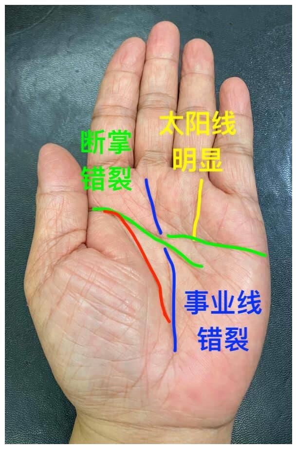 我给太阳唱支歌左手图片