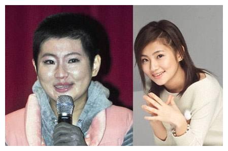 selina被烧伤毁容后张承中娶她5年又离婚背后原因太讽刺