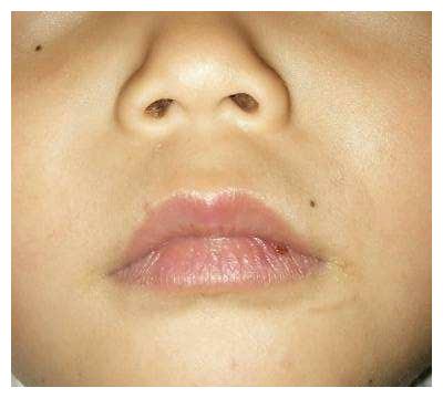 积食最怕"一种水",宝宝连喝3周,消积食,胃口好,睡觉踏实了