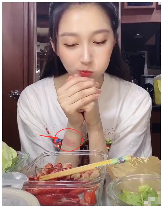 关晓彤录视频总藏着右手,当看到手腕"红印",瞬间明白了