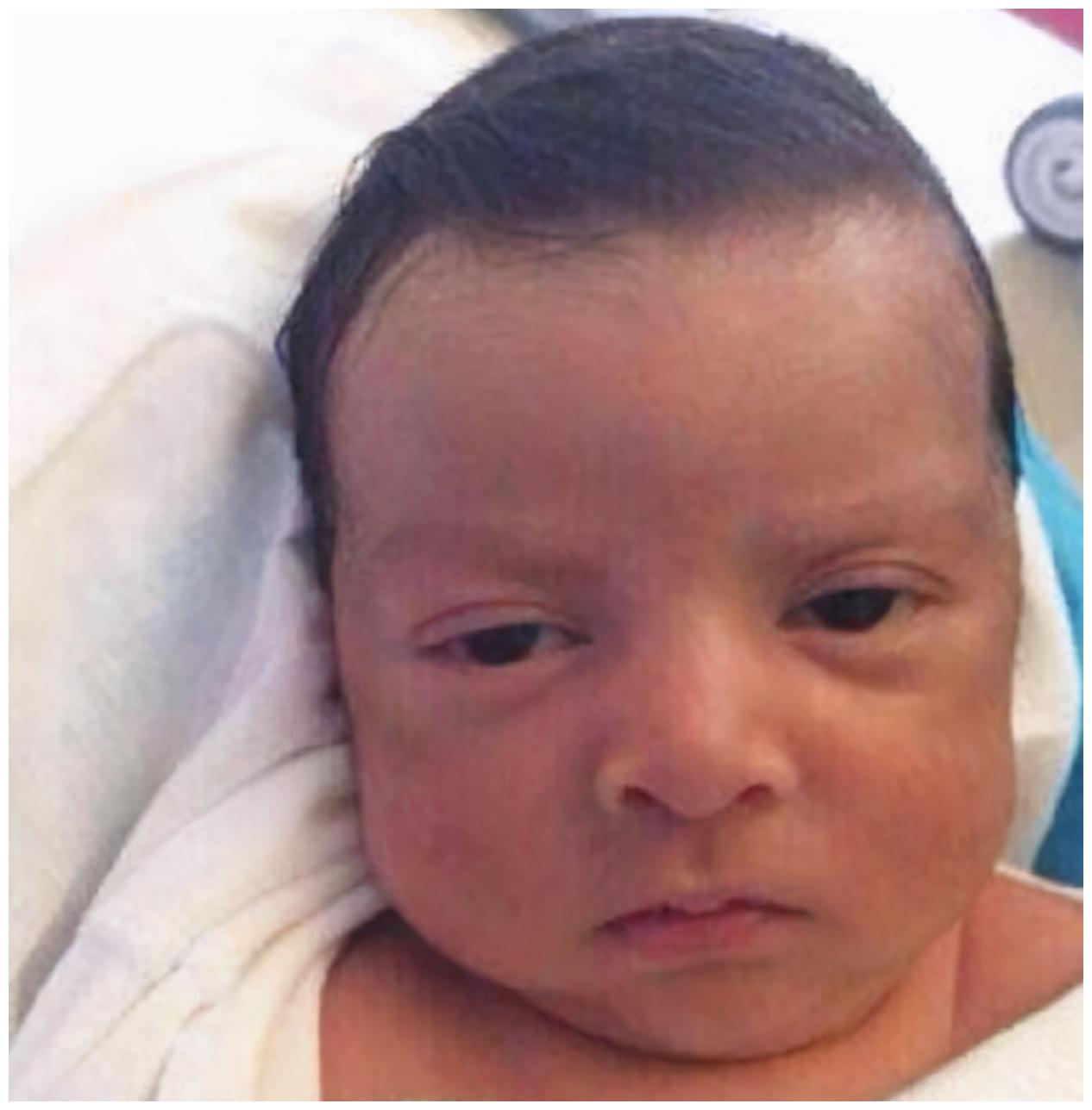 孩子将来会不会是高颜值娃出生时3个地方越丑长大颜值越高