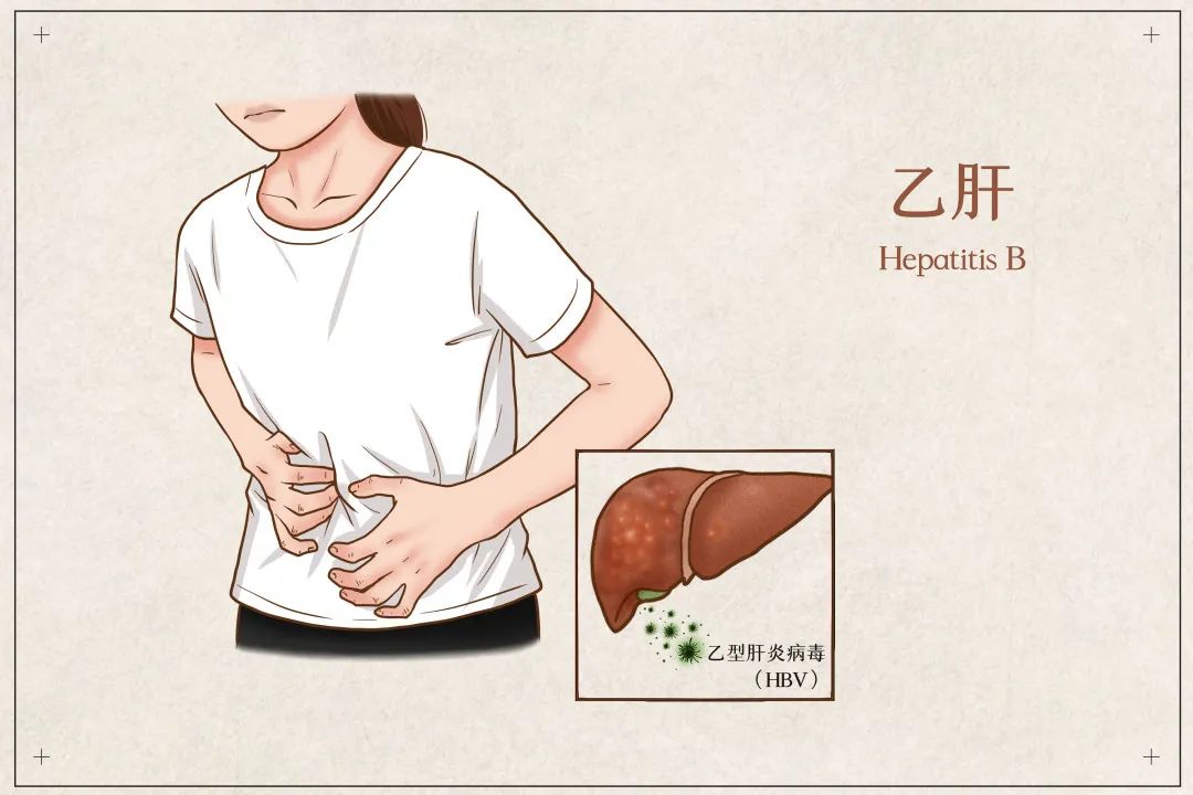 在早期阶段,大部分人仅是急性乙肝.