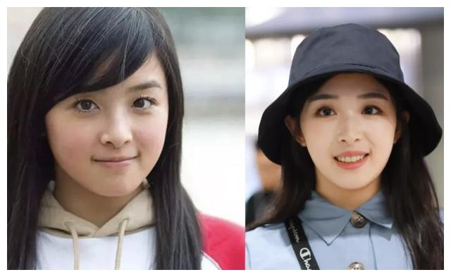 张含韵的眼睛不仅仅是自然老化垂下来的···她是画眼影给自己往下扫