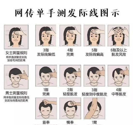 41岁张柏芝单手测发际线只有三指发量引人羡慕