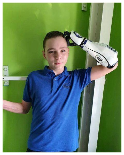 最后引起了严重的脑膜炎,当时医生对文森特的妈妈说,文森特只能够存活