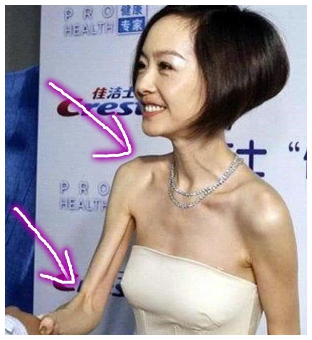 "瘦到脱相"的5位女星,杨颖郑爽不算啥,最后一位太吓人!