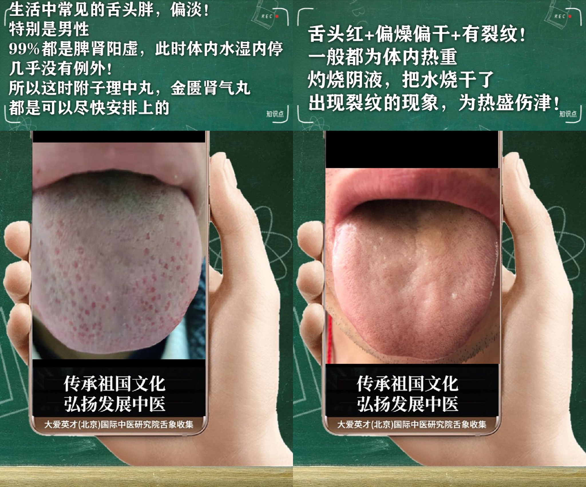 经常感到头晕目眩,心烦易怒,大便干结,心肾不交的舌象讲解|胰岛素|不降|大便_新浪新闻