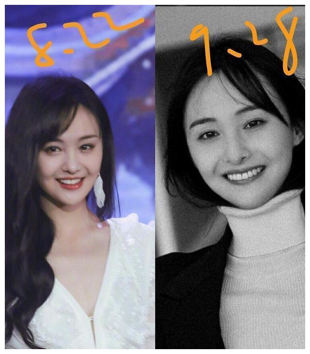 郑爽出现整容后遗症?鼻子变化明显上热搜,网友指出动了这里