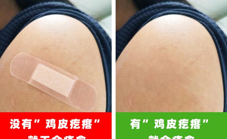 女朋友身上全是鸡皮疙瘩(女人身上的皮肤像鸡皮疙瘩一样的要怎么办) 女朋友身上全是鸡皮疙瘩(女人身上的皮肤像鸡皮疙瘩一样的要怎么办)