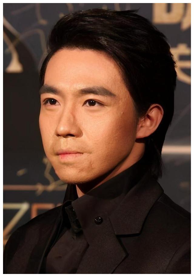 时隔10年,俞灏明无意显露烧伤双手,满是褶皱疤痕宛如80岁老人
