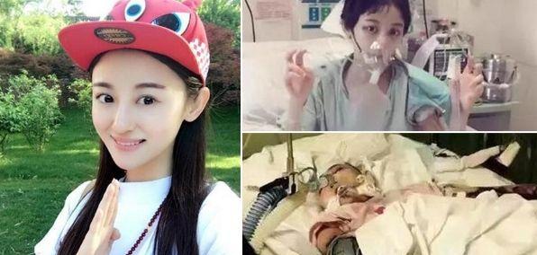 艺人徐婷被家人吸血十几年26岁患癌身体溃烂而死